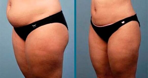 méthodes pour perdre du poids de 10 kilogrammes en un mois